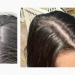 Nutrafol Review Does It Really Help With Hair Growth