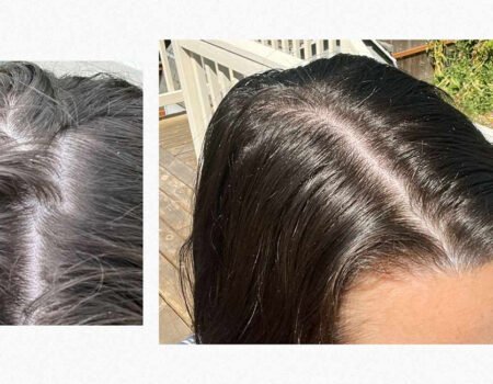 Nutrafol Review Does It Really Help With Hair Growth