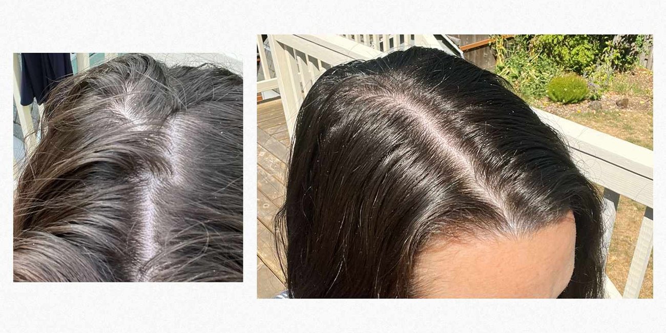 Nutrafol Review Does It Really Help With Hair Growth